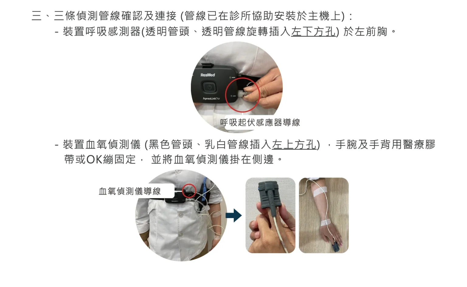 Esketamine鼻管使用方式